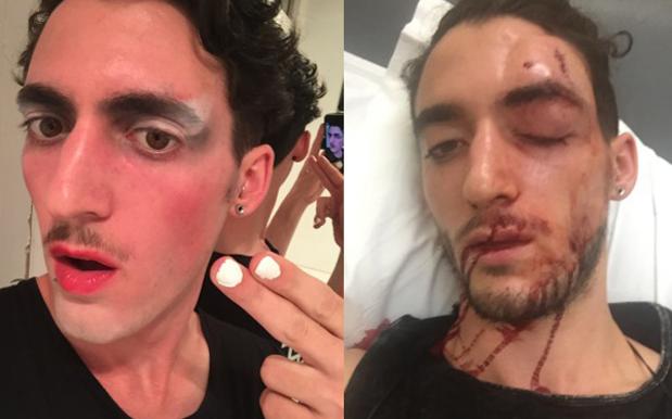 Protest To Keep Newtown ‘Weird & Safe’ Organised After Queer Man Bashed