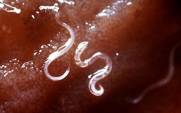 QLD Researchers Trial A Gut Full Of Hookworms As Cure For Coeliac Disease