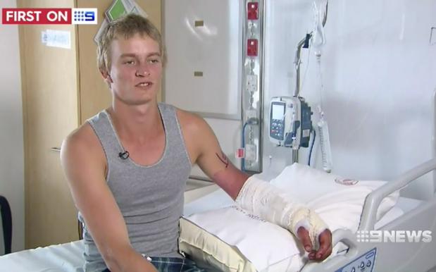 QLD Teen Mauled After Diving Into Croc River Says He’d Prob Do It Again, Aye