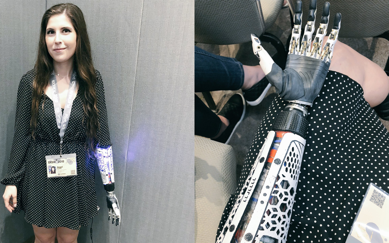 Woman With Bionic Prosthetic Was Refused Space To Charge Arm At Tech Panel