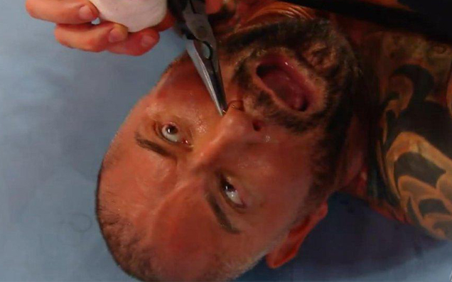 Watch Dave Batista Get His Nose Ring Ripped Out With Pliers At WrestleMania