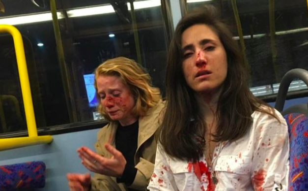 Four Teens Charged With Aggravated Hate Crime After Bus Attack Of Lesbian Couple