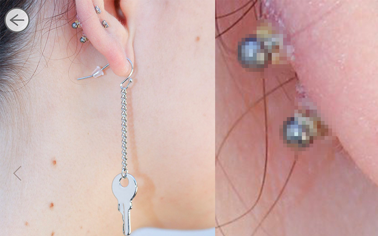 You Can’t Unsee This Model’s Infected-As-Hell Piercings, On Display In An Earring Campaign