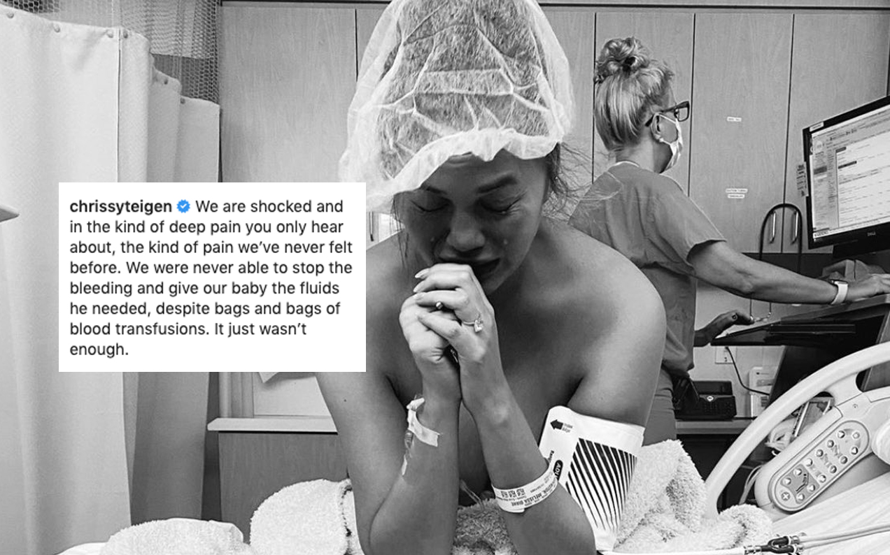 Chrissy Teigen Shares Gut-Wrenching News That She Suffered A Miscarriage In Her Third Pregnancy