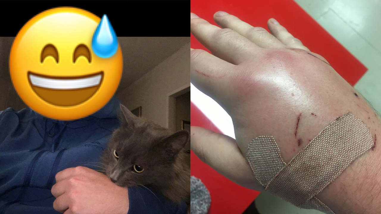 Come Cringe Over This Bloke Who Nearly Lost A Hand After Being Mauled By His Tinder Date’s Cat