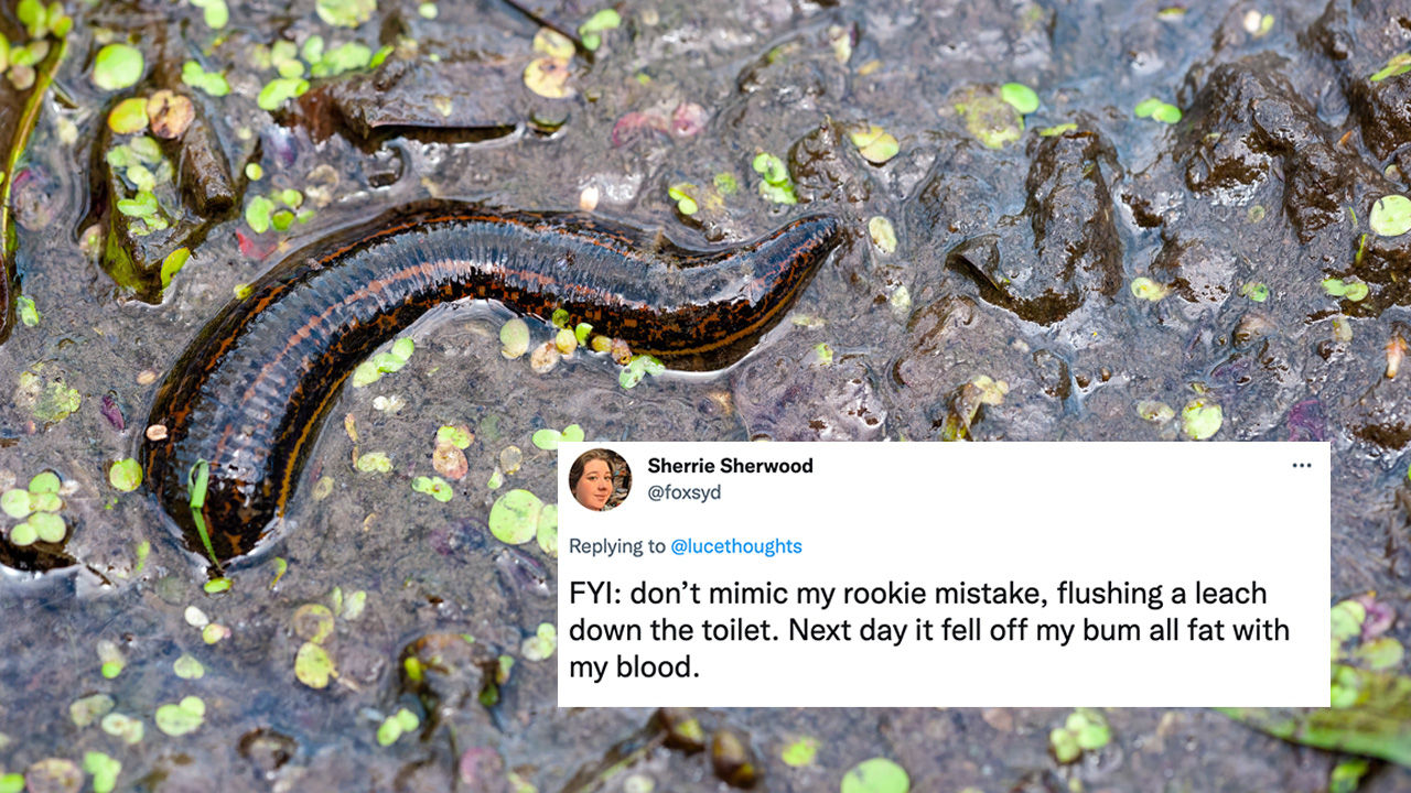 Sydneysiders Are Now Battling Leeches (!!!) In All This Wetness Which Absolutely Fucken Sucks