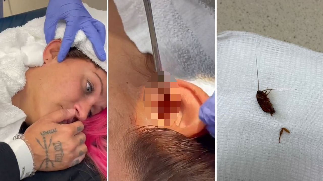 In Today’s Nightmare Fuel, This Woman Had A Whole Cockroach Pulled Out Of Her Ear